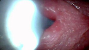 Endoscope catches raw male ejaculation in wild POV moment