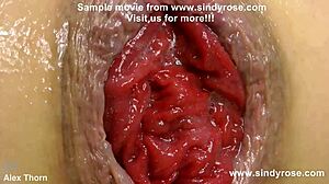 Sindy Rose Gets Extreme Anal Fisting on Kitchen Countertop, Causing Prolapse