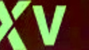 German blonde amateur needs big cocks in ass for painful assfuck 😈