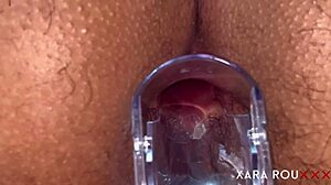 check out anal vision speculum in homemade bbw 😲