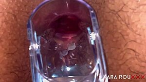 check out anal vision speculum in homemade bbw 😲