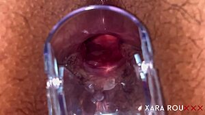 check out anal vision speculum in homemade bbw 😲