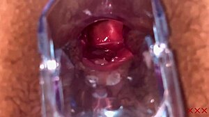 check out anal vision speculum in homemade bbw 😲