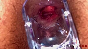 check out anal vision speculum in homemade bbw 😲