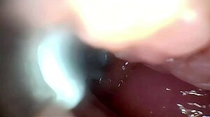 Pounding Semen Deep into Wide Stretched Cervix Pussy with Endoscope Closeup View