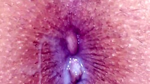 Slutty Wife Begs Anal Pound! Asshole Ripped Hard Hemorrhoids Burst