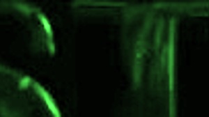 Albino dwarf teen first time monster cock anal wreck! 🍆🍑😈