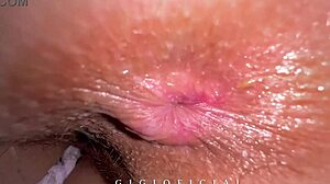 you see this girl fart wide on cam i filmed her ass inside now im proctologist